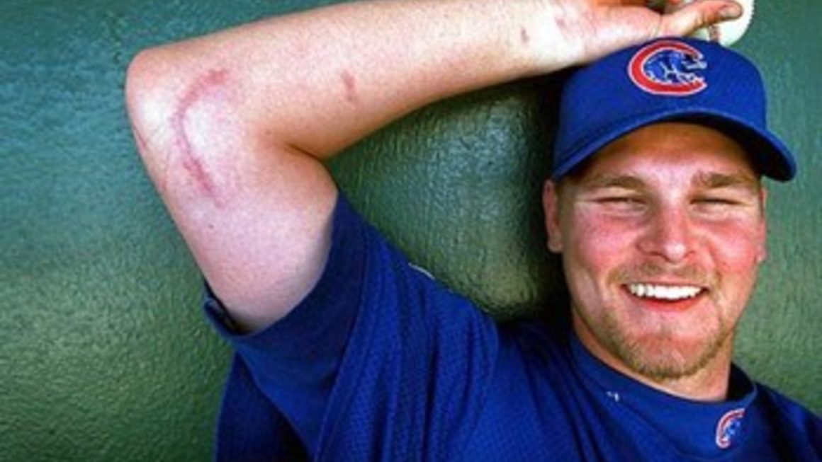 トミージョン手術：尺側側副靭帯再建手術とは