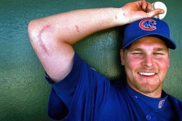 トミージョン手術：尺側側副靭帯再建手術とは